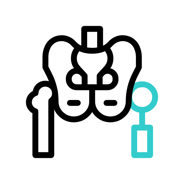 reemplazo de cadera guadalajara