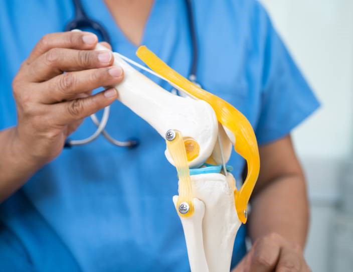 Médico ortopedista para reemplazo de rodilla